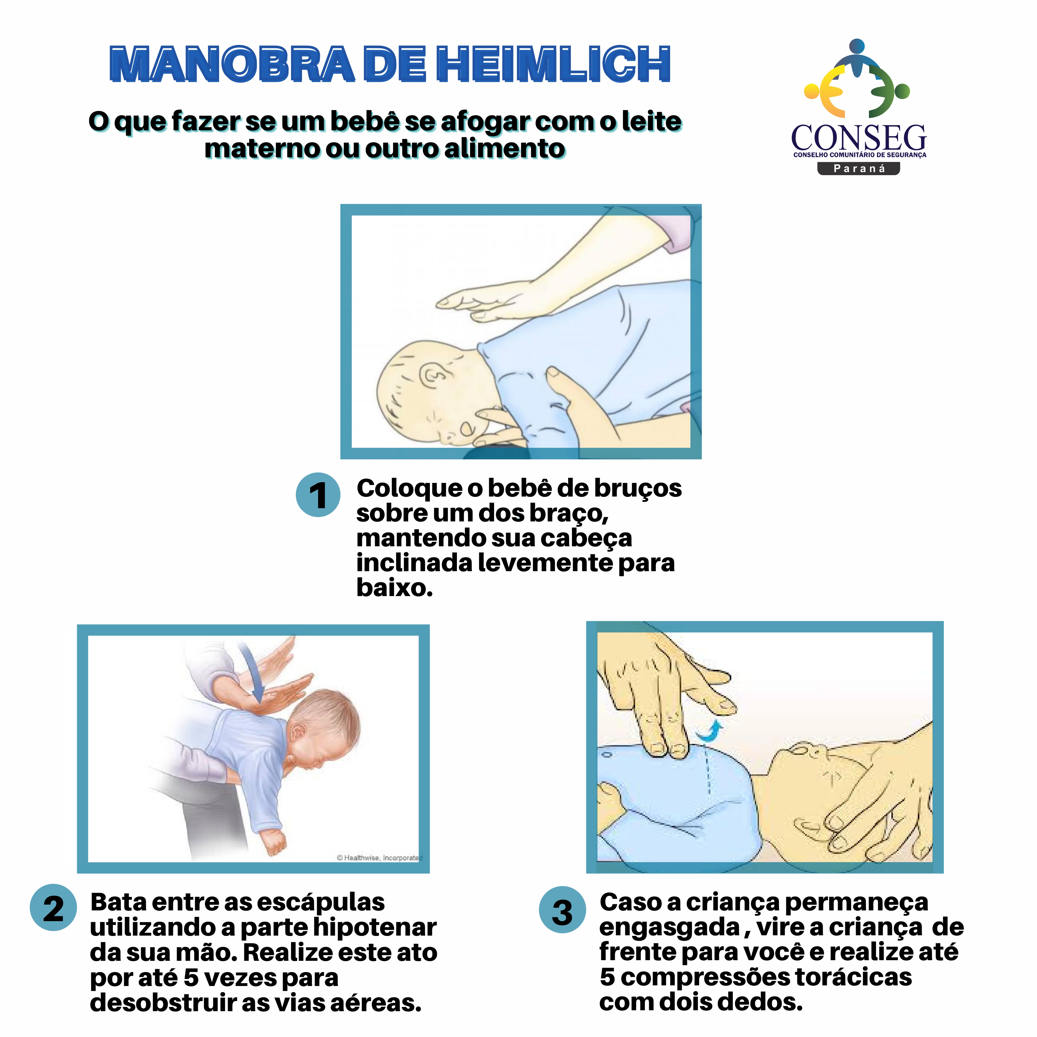 MANOBRA DE HEIMLICH